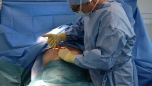 【画像】整形に失敗したセクシー女優のおっぱいがかわいそうｗｗ